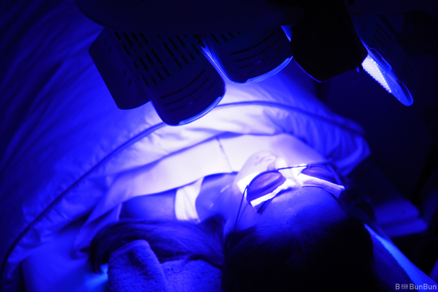 Tricks-For-Acne-Skin_1