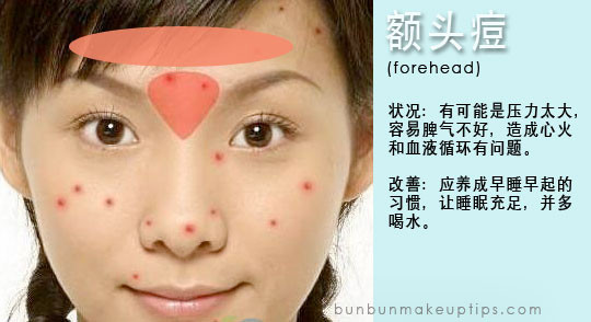 Acne and Health: What Your Body Is Trying To Tell You With Pimples!